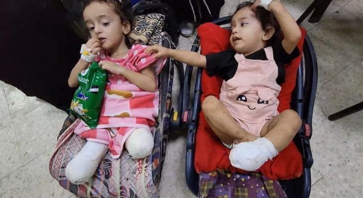 الأمم المتحدة: غزة تسجل أعداداً غير مسبوقة من الأطفال مبتوري الأطراف بسبب مخلفات الحرب