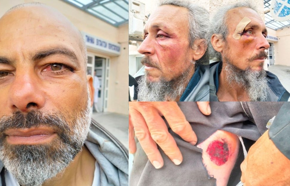 إصابة 31 ناشطاً في اعتداء إسرائيلي على "أسطول الصمود العالمي" بالمياه الدولية
