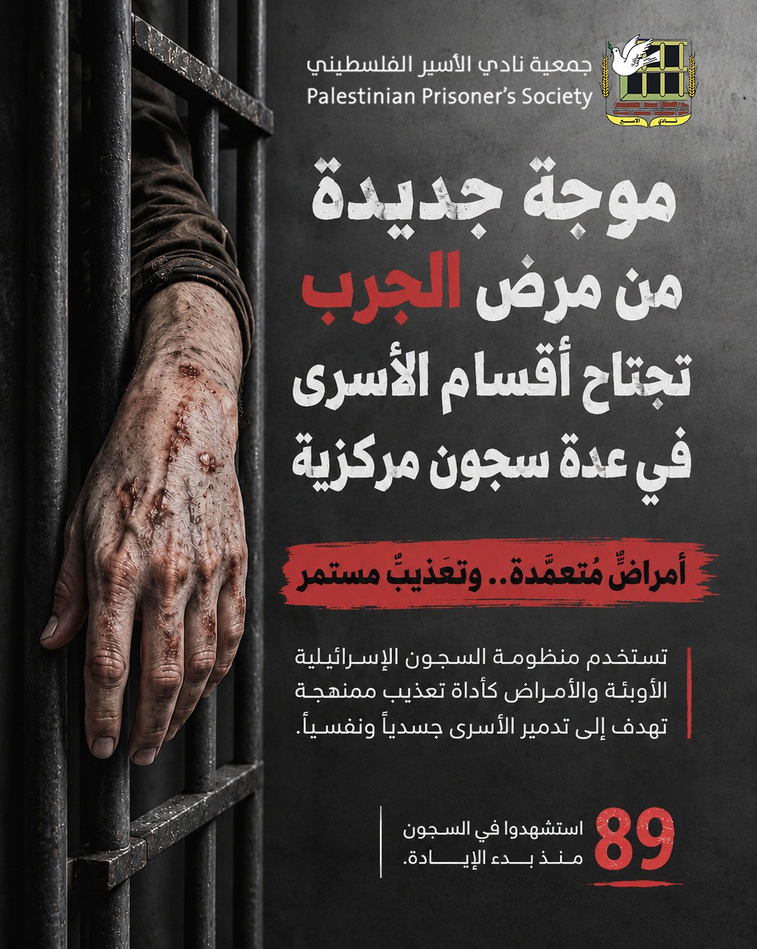 نادي الأسير: الجرب يجتاح أقسام الأسرى في سجون الاحتلال