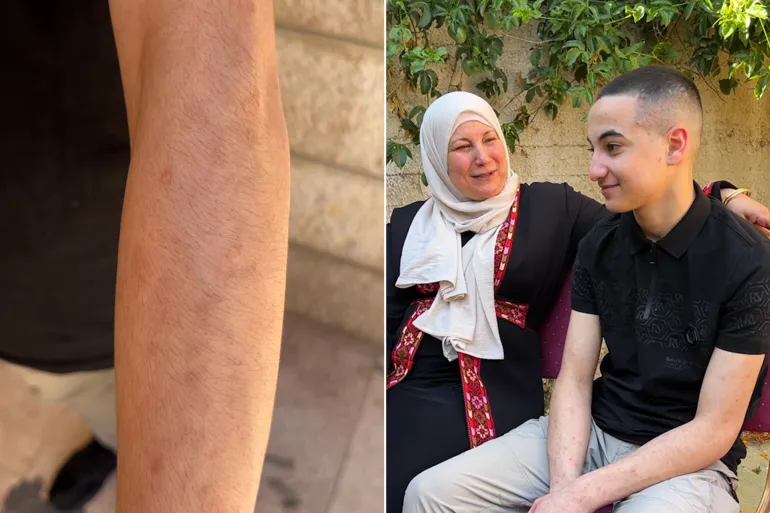"السجن مليء بالأطفال".. فتى فلسطيني يروي تفاصيل اعتقاله 20 شهرا
